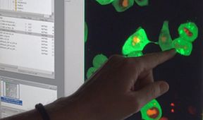 Příběhy moderní medicíny - Imunoterapie - léčba budoucnosti