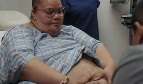 Zpackané operace proti obezitě (3)