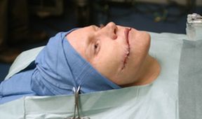 Plastická chirurgie s. r. o. III (4)